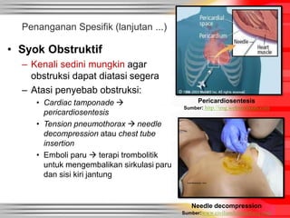 • Syok Obstruktif
– Kenali sedini mungkin agar
obstruksi dapat diatasi segera
– Atasi penyebab obstruksi:
• Cardiac tamponade 
pericardiosentesis
• Tension pneumothorax  needle
decompression atau chest tube
insertion
• Emboli paru  terapi trombolitik
untuk mengembalikan sirkulasi paru
dan sisi kiri jantung
Penanganan Spesifik (lanjutan ...)
Needle decompression
Sumber:www.civiliandefenseforce.com
Pericardiosentesis
Sumber: http://img.webmd.boots.com
 