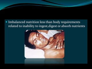  Imbalanced nutrition less than body requirements
 related to inability to ingest,digest or absorb nutrients
 