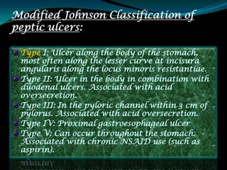 Modified Johnson Classification of
peptic ulcers:

 Type I: Ulcer along the body of the stomach,
 most often along the lesser curve at incisura
 angularis along the locus minoris resistantiae.
 Type II: Ulcer in the body in combination with
 duodenal ulcers. Associated with acid
 oversecretion.
 Type III: In the pyloric channel within 3 cm of
 pylorus. Associated with acid oversecretion.
 Type IV: Proximal gastroesophageal ulcer
 Type V: Can occur throughout the stomach.
 Associated with chronic NSAID use (such as
 aspirin).
 