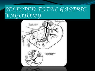 SELECTED TOTAL GASTRIC
VAGOTOMY
 