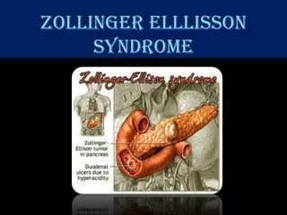 ZOLLINGER ELLLISSON
     SYNDROME
 