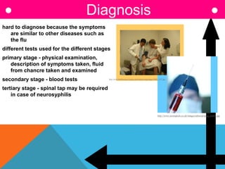 hard to diagnose because the symptoms
are similar to other diseases such as
the flu
different tests used for the different stages
primary stage - physical examination,
description of symptoms taken, fluid
from chancre taken and examined
secondary stage - blood tests
tertiary stage - spinal tap may be required
in case of neurosyphilis
Diagnosis
http://www.raisingkids.co.uk/images/editorial/preg_test02.jpg
http://www.healthsystem.virginia.edu/internet/cstap/images/IMG_1457.jpg
 