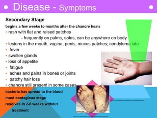 Secondary Stage
begins a few weeks to months after the chancre heals
• rash with flat and raised patches
- frequently on palms, soles, can be anywhere on body
• lesions in the mouth, vagina, penis, mucus patches; condyloma lata
• fever
• swollen glands
• loss of appetite
• fatigue
• aches and pains in bones or joints
• patchy hair loss
• chancre still present in some cases
bacteria has spread to the blood
most contagious stage
resolves in 2-6 weeks without
treatment
Disease - Symptoms
http://www.ratsteachmicro.com/Assets/Syphilis/syphilis/poem.jpg
http://www.worldsbest-sexual-health-site.com/images/Hand.jpg
http://www.scielo.br/img/revistas/abd/v80n1/ia09f07.jpg
 