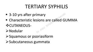 TERTIARY SYPHILIS
 3-10 yrs after primary
 Characteristic lesions are called GUMMA
CUTANEOUS-
Nodular
Squamous or psoriasiform
Subcutaneous gummata
 