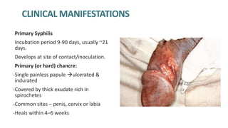 CLINICAL MANIFESTATIONS OF SYPHILIS
Primary Syphilis
Incubation period 9-90 days, usually ~21
days.
Develops at site of contact/inoculation.
Primary (or hard) chancre:
-Single painless papule ulcerated &
indurated
-Covered by thick exudate rich in
spirochetes
-Common sites – penis, cervix or labia
-Heals within 4–6 weeks
 
