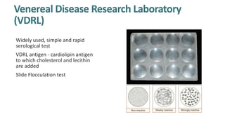 Venereal Disease Research Laboratory
(VDRL)
Widely used, simple and rapid
serological test
VDRL antigen - cardiolipin antigen
to which cholesterol and lecithin
are added
Slide Flocculation test
 