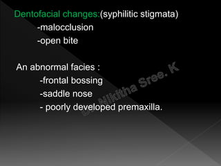 Dentofacial changes:(syphilitic stigmata)
-malocclusion
-open bite
An abnormal facies :
-frontal bossing
-saddle nose
- poorly developed premaxilla.
 