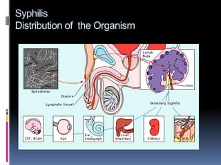 Syphilis 2 .pptx . | PPTX