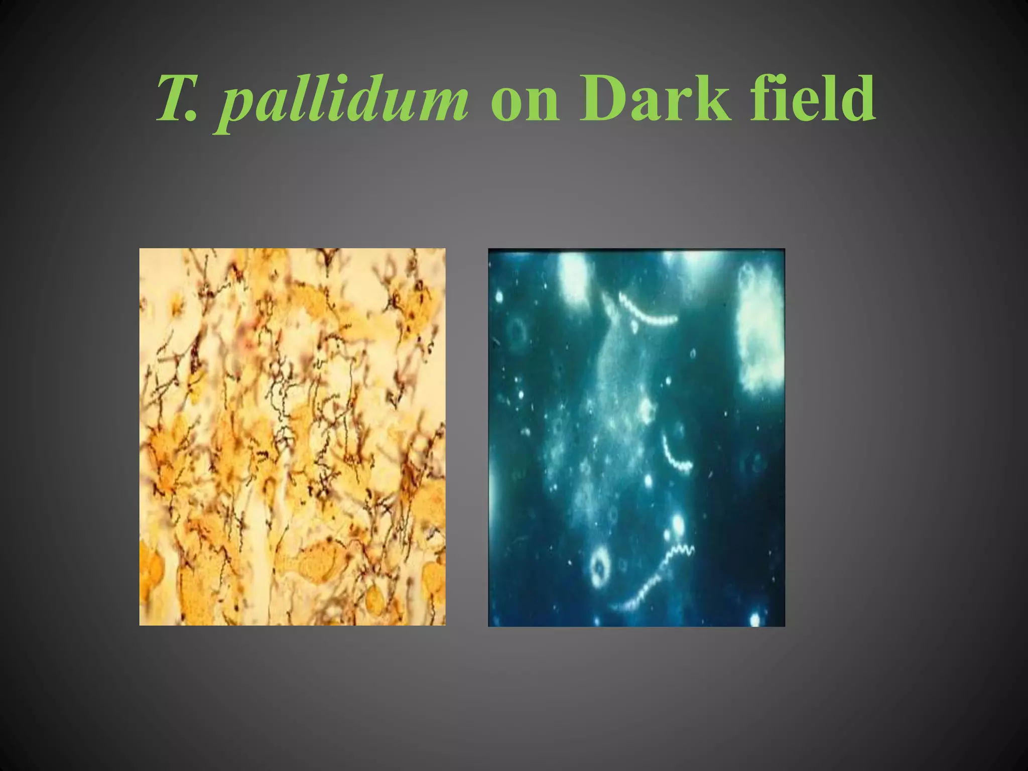 T. pallidum on Dark field
 