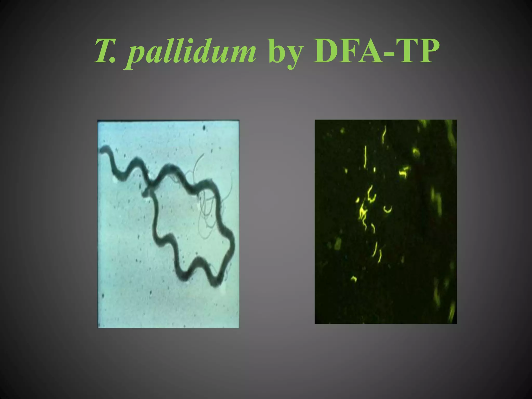 T. pallidum by DFA-TP
 