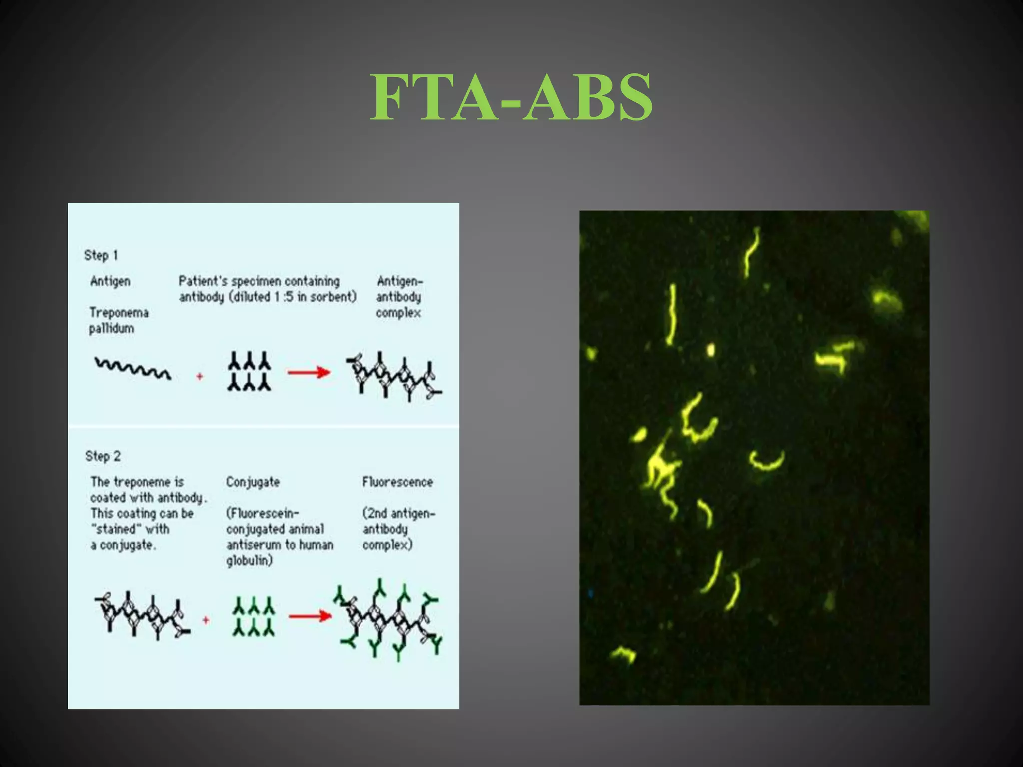 FTA-ABS
 