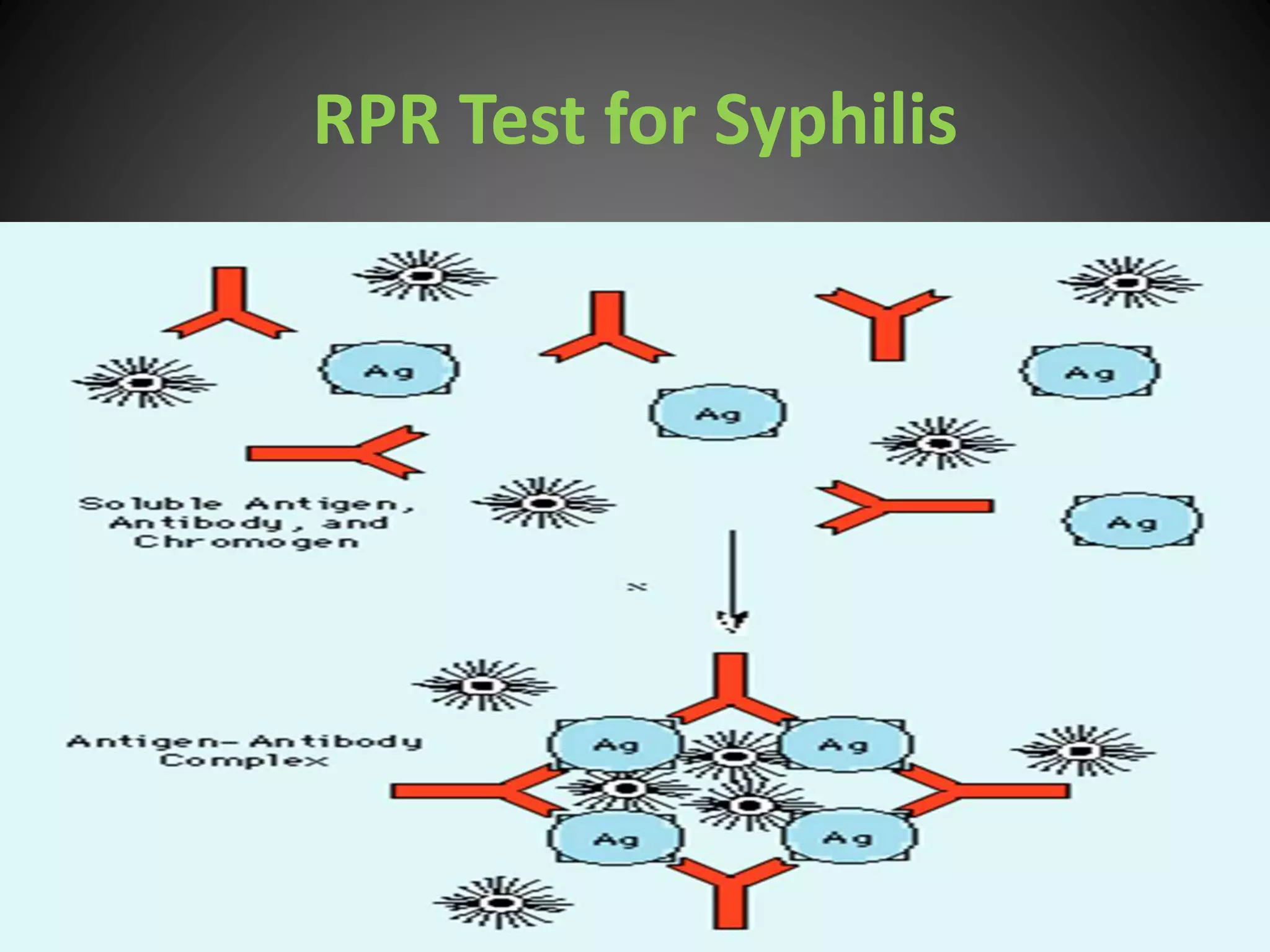 RPR Test for Syphilis
 