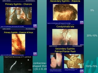 corkscrew-
shaped thin
(0.1-0.18(
10%-20%
75%-100%
5%
 