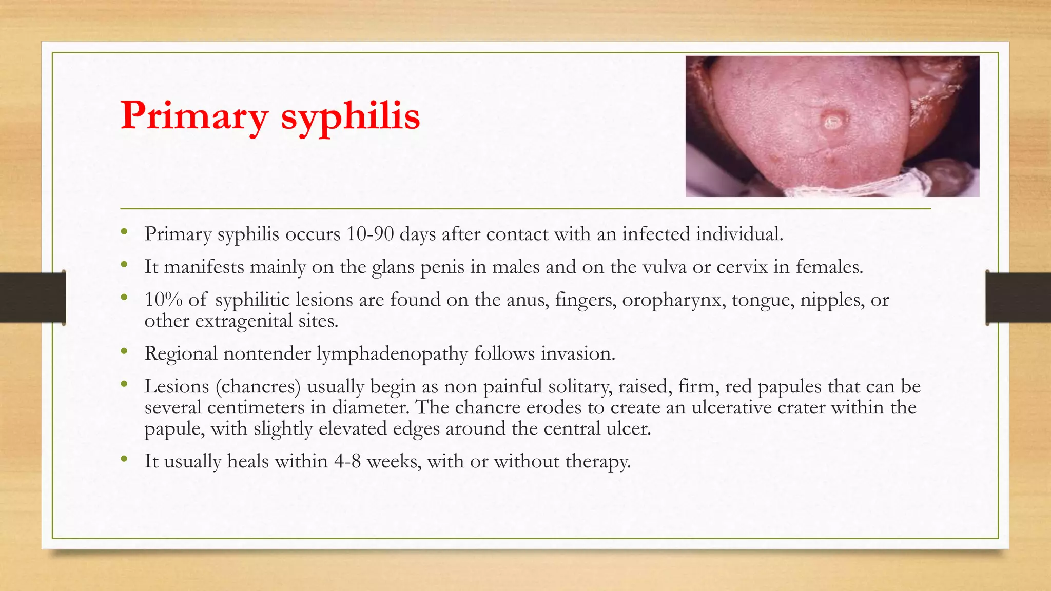 Primary syphilis
• Primary syphilis occurs 10-90 days after contact with an infected individual.
• It manifests mainly on the glans penis in males and on the vulva or cervix in females.
• 10% of syphilitic lesions are found on the anus, fingers, oropharynx, tongue, nipples, or
other extragenital sites.
• Regional nontender lymphadenopathy follows invasion.
• Lesions (chancres) usually begin as non painful solitary, raised, firm, red papules that can be
several centimeters in diameter. The chancre erodes to create an ulcerative crater within the
papule, with slightly elevated edges around the central ulcer.
• It usually heals within 4-8 weeks, with or without therapy.
 