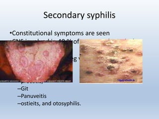 Secondary syphilis
•Constitutional symptoms are seen
•CNS involved in 40 % of patients. ( Headache
and meningismus).
•Any organ involved, eg with
–Renal involements,
–syphilitis hepatis
–proctitis,
–Git
–Panuveitis
–ostieits, and otosyphilis.
 