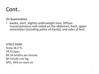 Cont..
On Examination
• awake, alert, slightly underweight man, Diffuse
mucocutaneous rash noted on the abdomen, back, upper
extremities (including palms of hands), and soles of feet.
VITALS SIGNS.
Temp 38.3 0C,
PR 72 bpm,
RR 16 breaths per minute,
BP 141/85 mm Hg,
SPO2 94% on room air
7
 