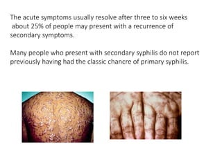 The acute symptoms usually resolve after three to six weeks
about 25% of people may present with a recurrence of
secondary symptoms.
Many people who present with secondary syphilis do not report
previously having had the classic chancre of primary syphilis.
 