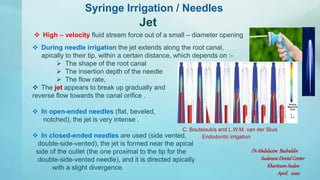 Syringe irrigation [autosaved] | PPTX