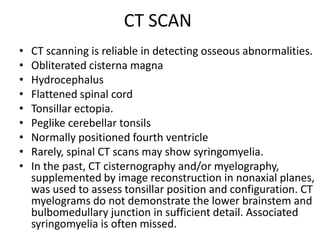 Other manifestationsArm reflex diminshed or absent