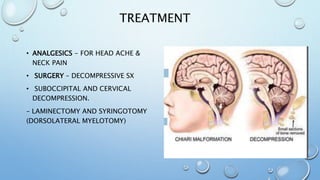 TREATMENT
• ANALGESICS - FOR HEAD ACHE &
NECK PAIN
• SURGERY – DECOMPRESSIVE SX
• SUBOCCIPITAL AND CERVICAL
DECOMPRESSION.
– LAMINECTOMY AND SYRINGOTOMY
(DORSOLATERAL MYELOTOMY)
 
