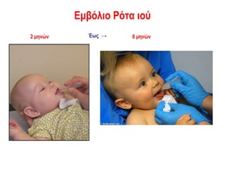 Εμβόλιο Ρότα ιού
2 μηνών     Έως →     8 μηνών
 