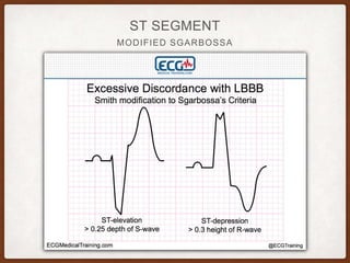 MODIFIED SGARBOSSA
ST SEGMENT
 