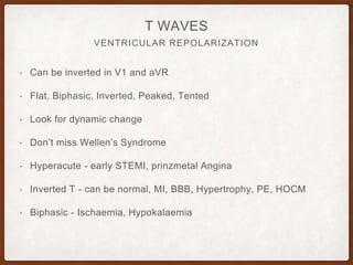 VENTRICULAR REPOLARIZATION
T WAVES
• Can be inverted in V1 and aVR
• Flat, Biphasic, Inverted, Peaked, Tented
• Look for dynamic change
• Don’t miss Wellen’s Syndrome
• Hyperacute - early STEMI, prinzmetal Angina
• Inverted T - can be normal, MI, BBB, Hypertrophy, PE, HOCM
• Biphasic - Ischaemia, Hypokalaemia
 