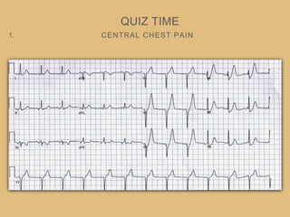 CENTRAL CHEST PAIN
QUIZ TIME
1.
 