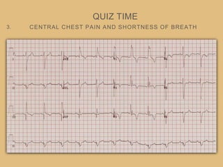 CENTRAL CHEST PAIN AND SHORTNESS OF BREATH
QUIZ TIME
3.
 