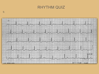 RHYTHM QUIZ
9.
 