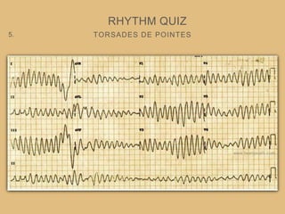 TORSADES DE POINTES
RHYTHM QUIZ
5.
 