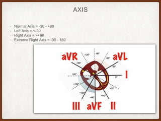 AXIS
• Normal Axis = -30 - +90
• Left Axis = <-30
• Right Axis = >+90
• Extreme Right Axis = -90 - 180
 