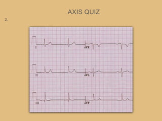 AXIS QUIZ
2.
 
