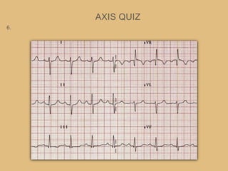 AXIS QUIZ
6.
 