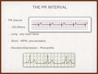 THE PR INTERVAL
• PR Interval
• 120-200ms
• Long - any heart block
• Short - WPW, pre-excitation
• Elevation/Depression - Pericarditis
 