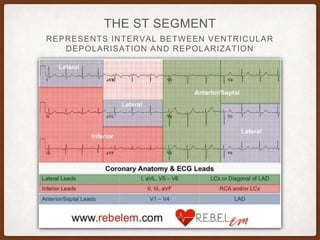 REPRESENTS INTERVAL BETWEEN VENTRICULAR
DEPOLARISATION AND REPOLARIZATION
THE ST SEGMENT
 