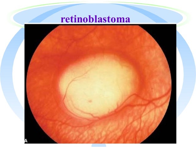 Best 30 Eye Doctor In Gaffney Sc With Reviews Yp Com