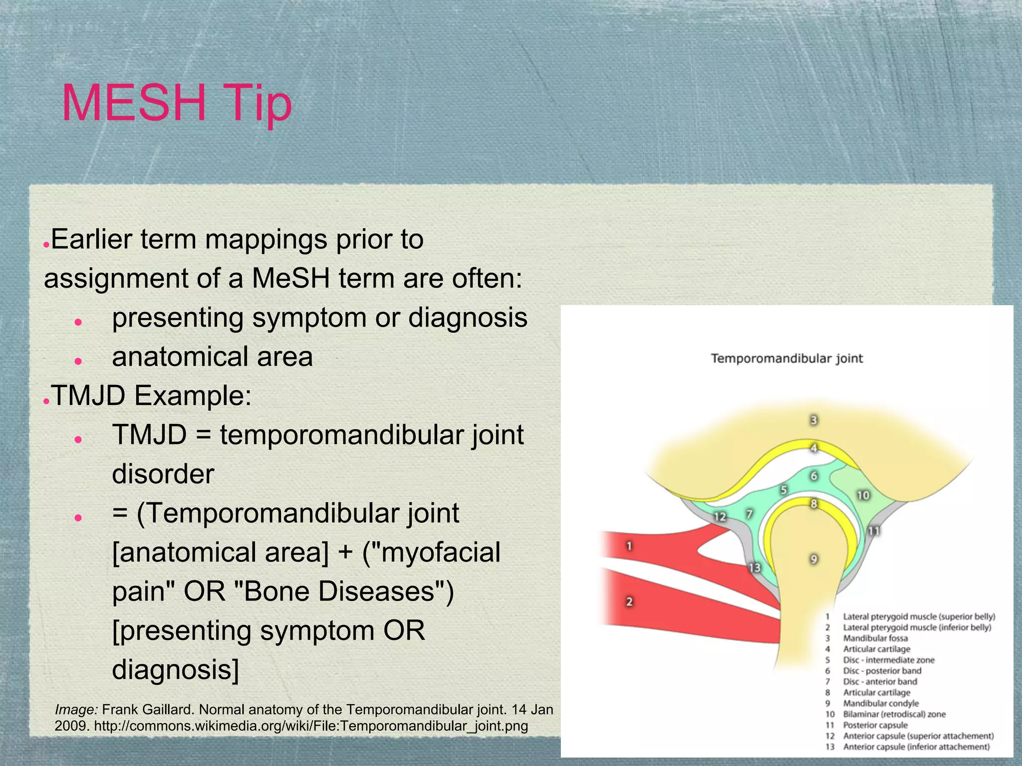 MESH Tip

●Earlier term mappings prior to
assignment of a MeSH term are often:
  ●   presenting symptom or diagnosis
  ●   anatomical area
●TMJD Example:

  ●   TMJD = temporomandibular joint
      disorder
  ●   = (Temporomandibular joint
      [anatomical area] + ("myofacial
      pain" OR "Bone Diseases")
      [presenting symptom OR
      diagnosis]
    Image: Frank Gaillard. Normal anatomy of the Temporomandibular joint. 14 Jan
    2009. http://commons.wikimedia.org/wiki/File:Temporomandibular_joint.png
 