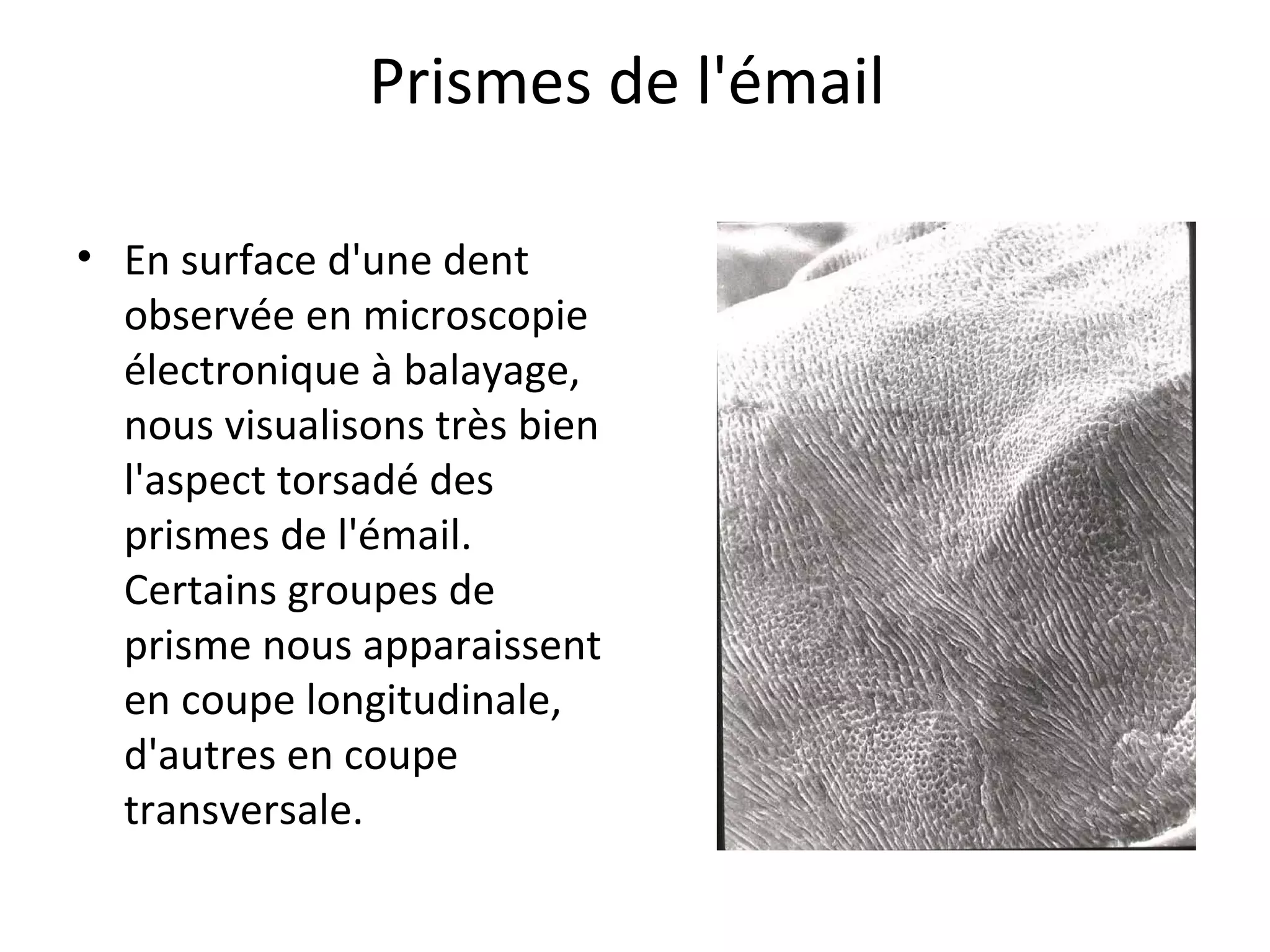 Prismes de l'émail
• En surface d'une dent
observée en microscopie
électronique à balayage,
nous visualisons très bien
l'aspect torsadé des
prismes de l'émail.
Certains groupes de
prisme nous apparaissent
en coupe longitudinale,
d'autres en coupe
transversale.
 
