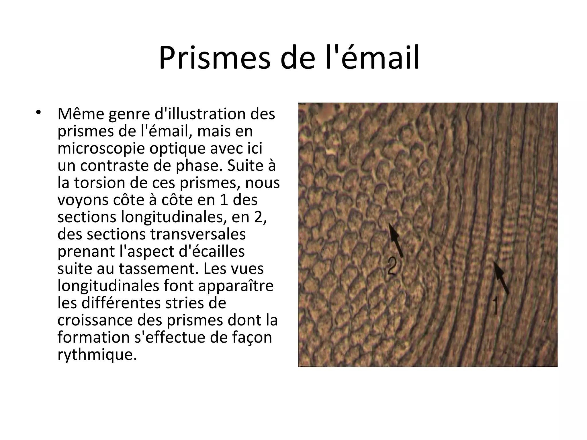 Prismes de l'émail
• Même genre d'illustration des
prismes de l'émail, mais en
microscopie optique avec ici
un contraste de phase. Suite à
la torsion de ces prismes, nous
voyons côte à côte en 1 des
sections longitudinales, en 2,
des sections transversales
prenant l'aspect d'écailles
suite au tassement. Les vues
longitudinales font apparaître
les différentes stries de
croissance des prismes dont la
formation s'effectue de façon
rythmique.
 