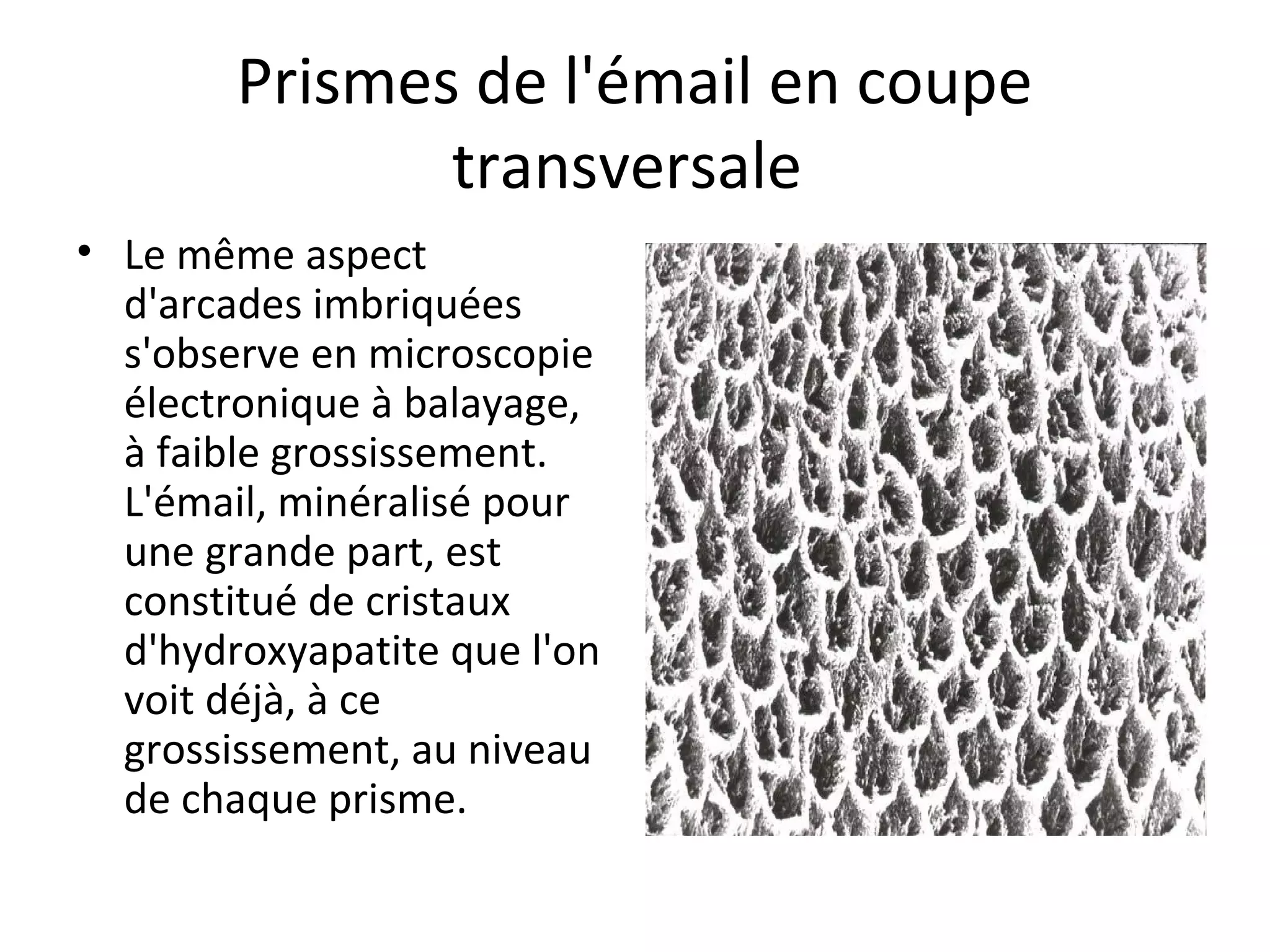 Prismes de l'émail en coupe
transversale
• Le même aspect
d'arcades imbriquées
s'observe en microscopie
électronique à balayage,
à faible grossissement.
L'émail, minéralisé pour
une grande part, est
constitué de cristaux
d'hydroxyapatite que l'on
voit déjà, à ce
grossissement, au niveau
de chaque prisme.
 
