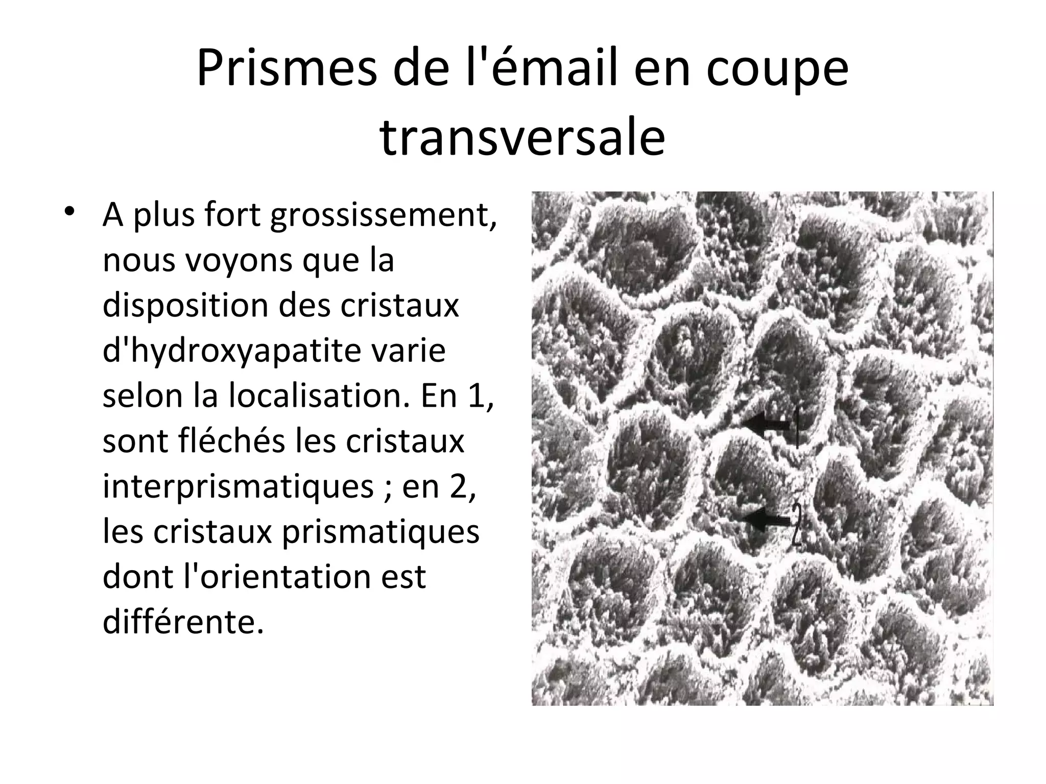 Prismes de l'émail en coupe
transversale
• A plus fort grossissement,
nous voyons que la
disposition des cristaux
d'hydroxyapatite varie
selon la localisation. En 1,
sont fléchés les cristaux
interprismatiques ; en 2,
les cristaux prismatiques
dont l'orientation est
différente.
 