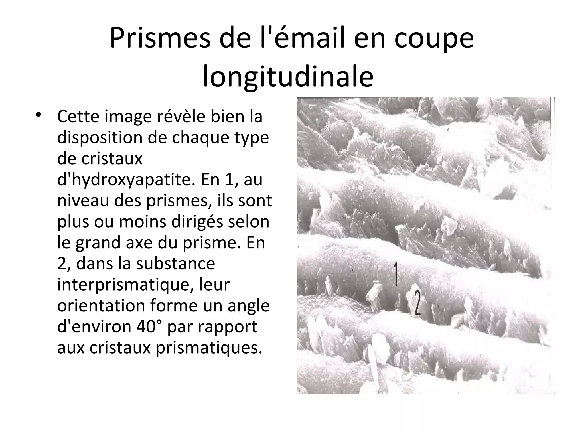 Prismes de l'émail en coupe
longitudinale
• Cette image révèle bien la
disposition de chaque type
de cristaux
d'hydroxyapatite. En 1, au
niveau des prismes, ils sont
plus ou moins dirigés selon
le grand axe du prisme. En
2, dans la substance
interprismatique, leur
orientation forme un angle
d'environ 40° par rapport
aux cristaux prismatiques.
 