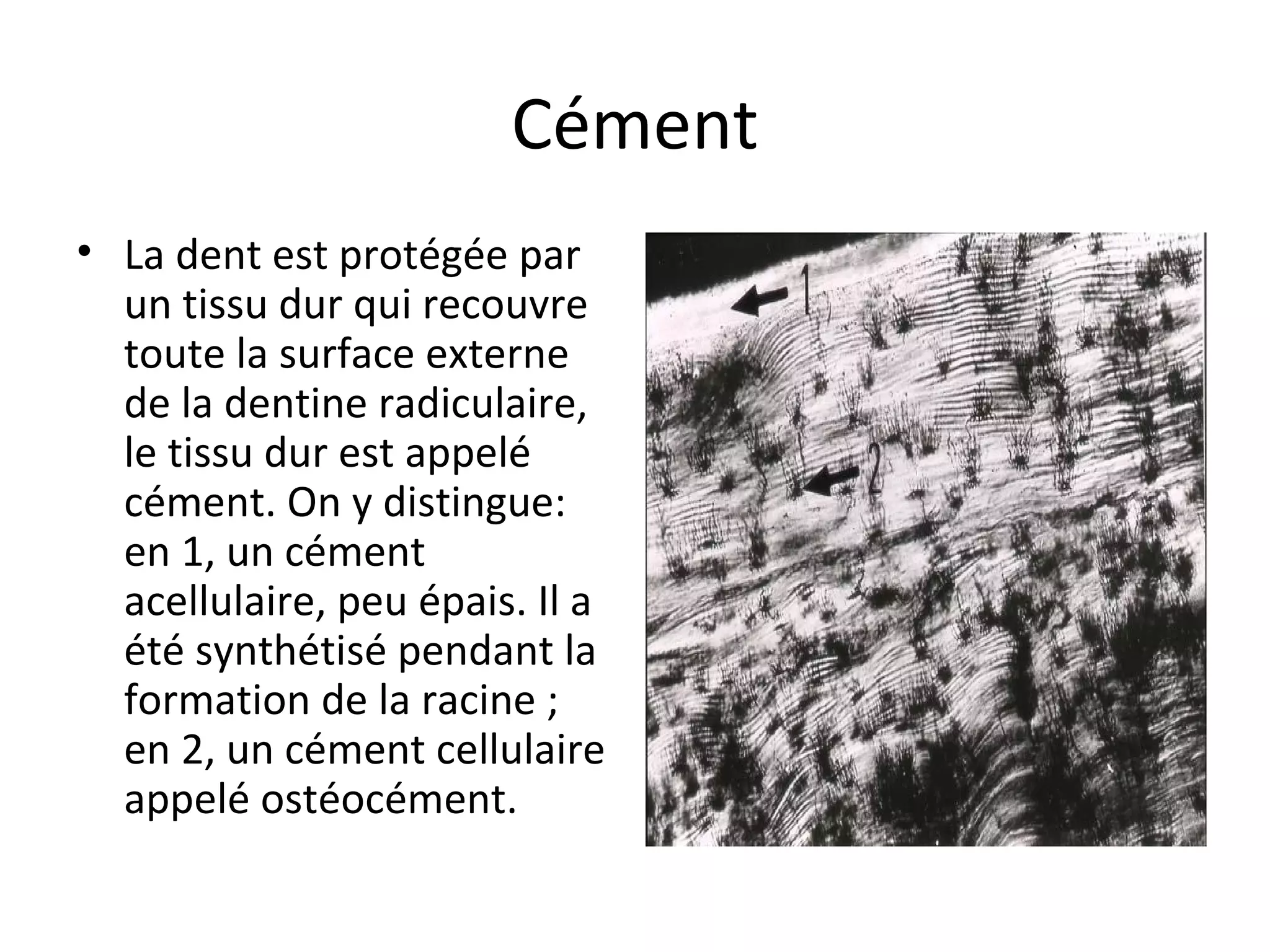 Cément
• La dent est protégée par
un tissu dur qui recouvre
toute la surface externe
de la dentine radiculaire,
le tissu dur est appelé
cément. On y distingue:
en 1, un cément
acellulaire, peu épais. Il a
été synthétisé pendant la
formation de la racine ;
en 2, un cément cellulaire
appelé ostéocément.
 