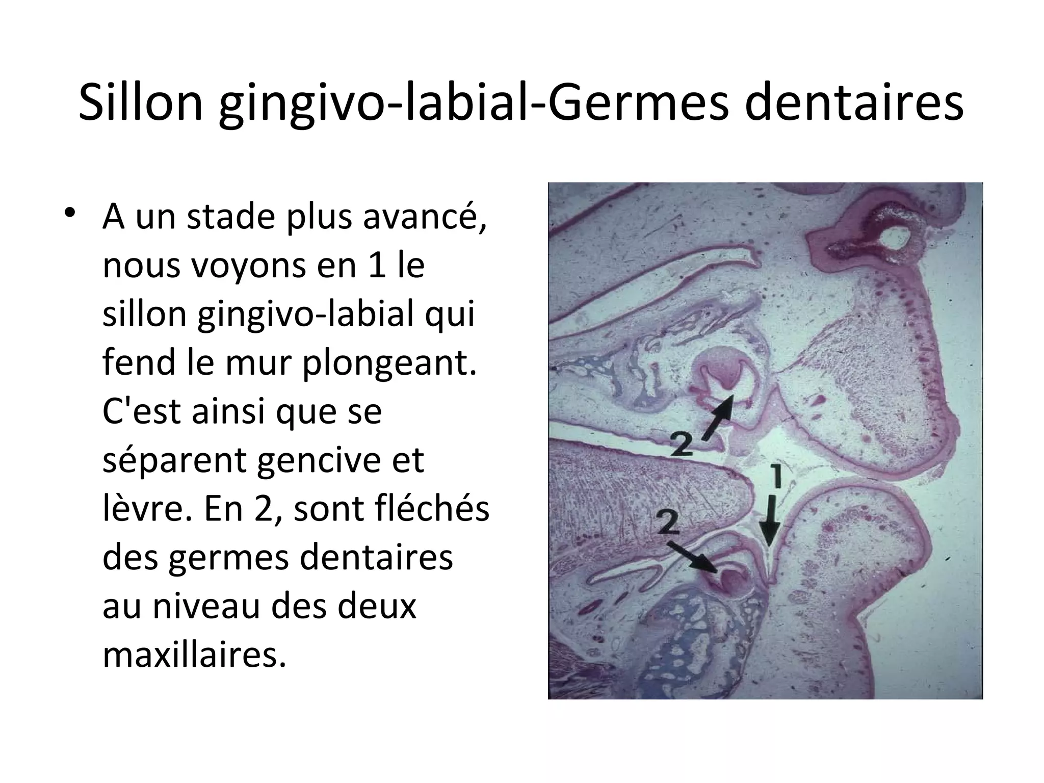 Sillon gingivo-labial-Germes dentaires
• A un stade plus avancé,
nous voyons en 1 le
sillon gingivo-labial qui
fend le mur plongeant.
C'est ainsi que se
séparent gencive et
lèvre. En 2, sont fléchés
des germes dentaires
au niveau des deux
maxillaires.
 
