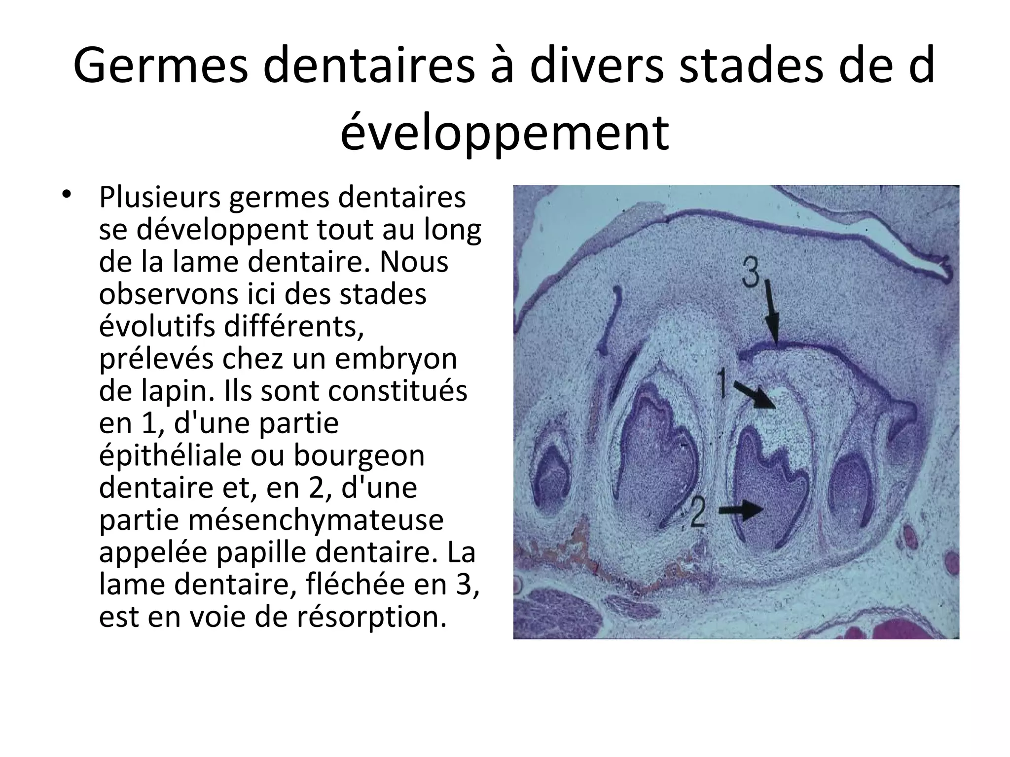 Germes dentaires à divers stades de d
éveloppement
• Plusieurs germes dentaires
se développent tout au long
de la lame dentaire. Nous
observons ici des stades
évolutifs différents,
prélevés chez un embryon
de lapin. Ils sont constitués
en 1, d'une partie
épithéliale ou bourgeon
dentaire et, en 2, d'une
partie mésenchymateuse
appelée papille dentaire. La
lame dentaire, fléchée en 3,
est en voie de résorption.
 
