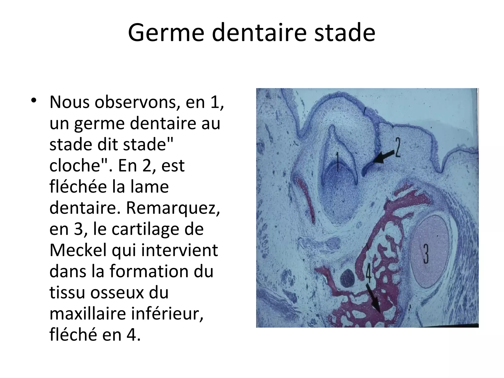 Germe dentaire stade
• Nous observons, en 1,
un germe dentaire au
stade dit stade"
cloche". En 2, est
fléchée la lame
dentaire. Remarquez,
en 3, le cartilage de
Meckel qui intervient
dans la formation du
tissu osseux du
maxillaire inférieur,
fléché en 4.
 