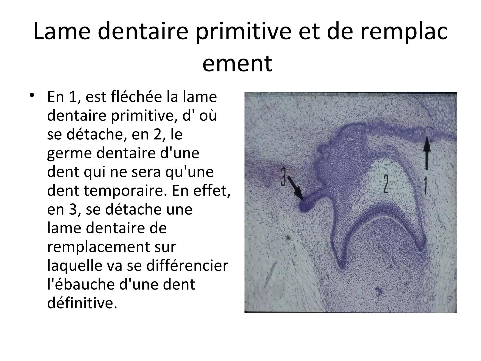 Lame dentaire primitive et de remplac
ement
• En 1, est fléchée la lame
dentaire primitive, d' où
se détache, en 2, le
germe dentaire d'une
dent qui ne sera qu'une
dent temporaire. En effet,
en 3, se détache une
lame dentaire de
remplacement sur
laquelle va se différencier
l'ébauche d'une dent
définitive.
 