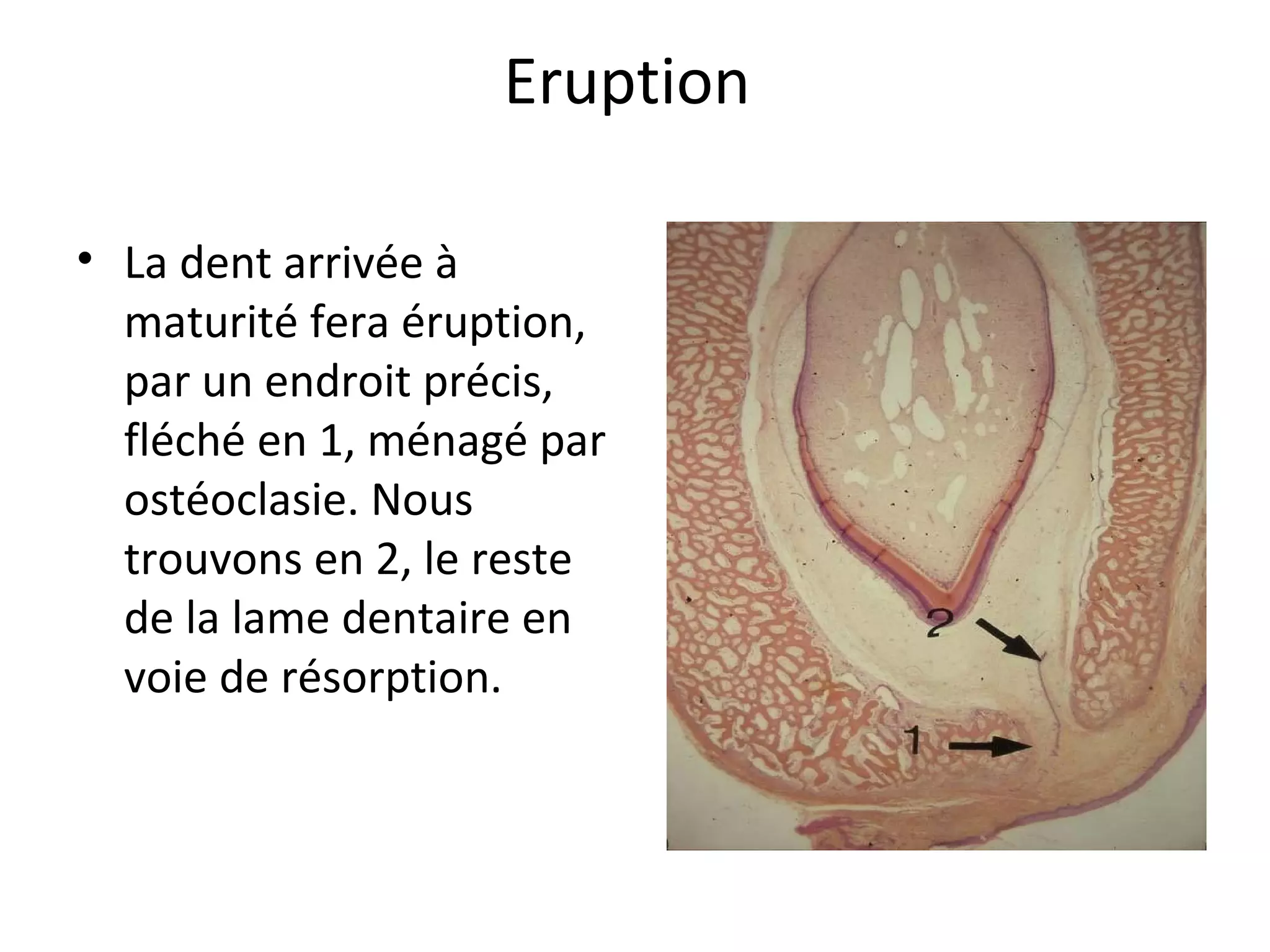 Eruption
• La dent arrivée à
maturité fera éruption,
par un endroit précis,
fléché en 1, ménagé par
ostéoclasie. Nous
trouvons en 2, le reste
de la lame dentaire en
voie de résorption.
 