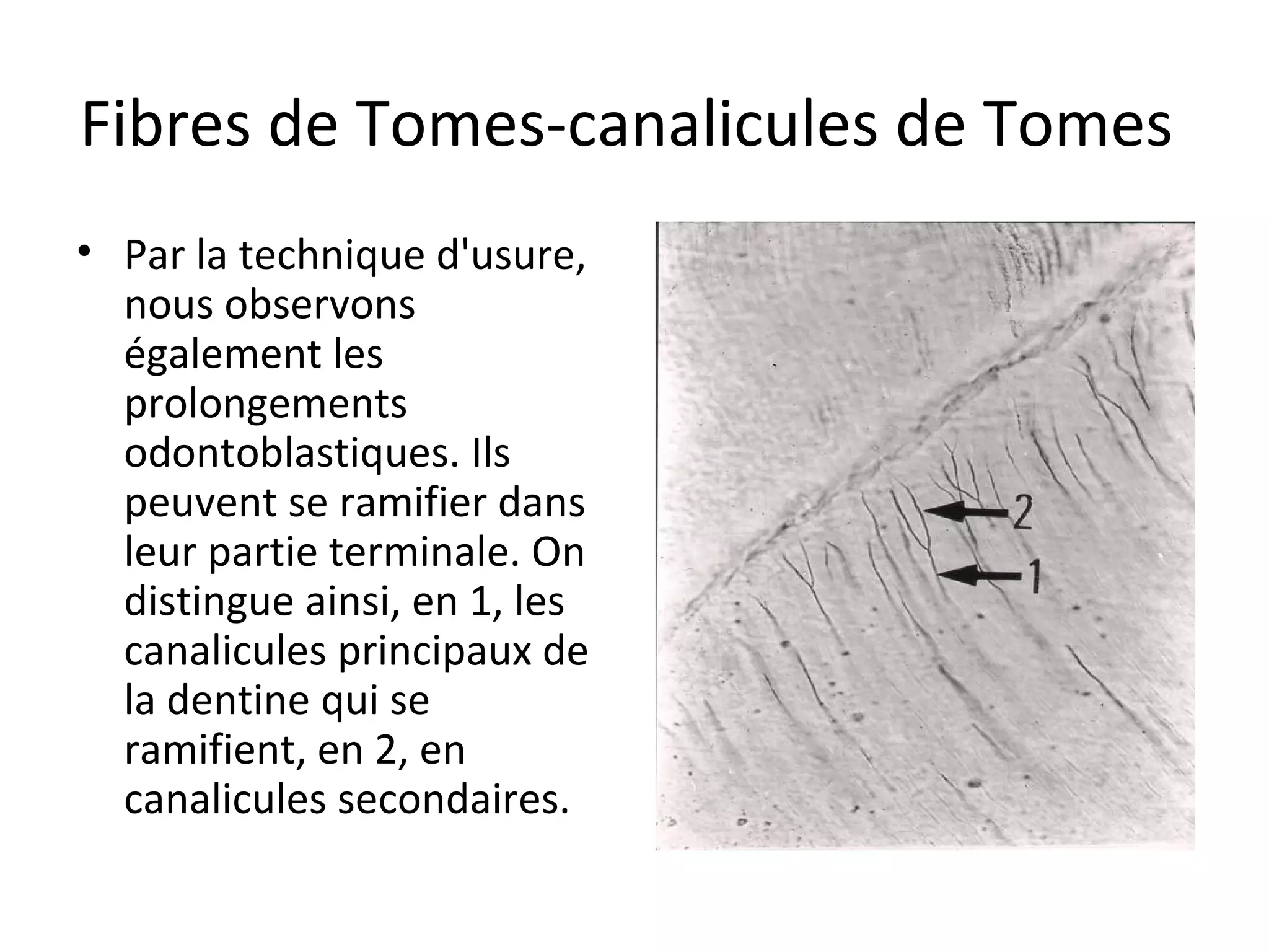 Fibres de Tomes-canalicules de Tomes
• Par la technique d'usure,
nous observons
également les
prolongements
odontoblastiques. Ils
peuvent se ramifier dans
leur partie terminale. On
distingue ainsi, en 1, les
canalicules principaux de
la dentine qui se
ramifient, en 2, en
canalicules secondaires.
 